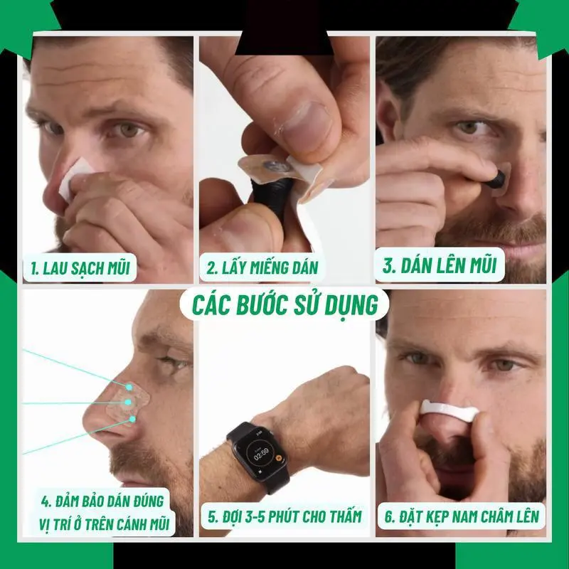 【COD】Cứu tinh nghẹt mũi! Bộ mở rộng hô hấp từ tính, dụng cụ thông khí thể thao, giúp thở dễ dàng hơn! 1