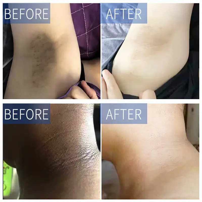 Krim Pemutih ketiak 50gr Vitamin C Underarm Private Parts Whitening Cream Miss V Mencerahkan Selangkangan 5
