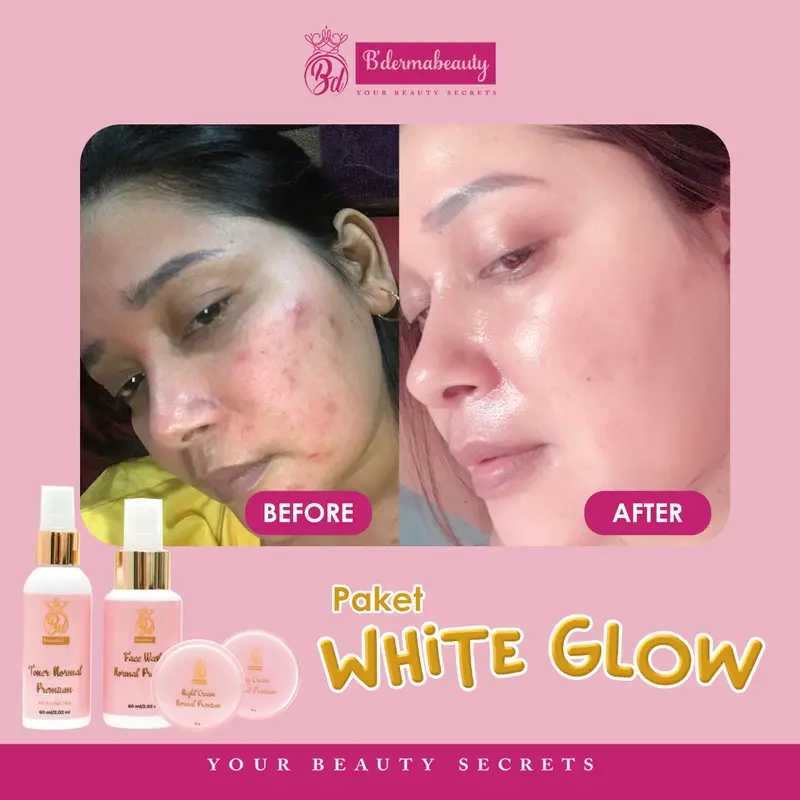 DAY & NIGHT WHITE GLOW - ECER BY BDERMABEAUTY Hitam Mencerahkan 2