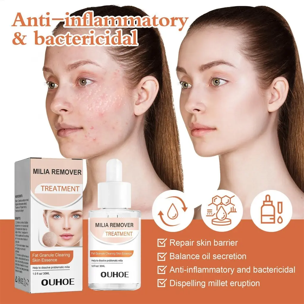 Milia Decontamination Moisturizing Fat Granules Repair stains Skin care products help dissolve