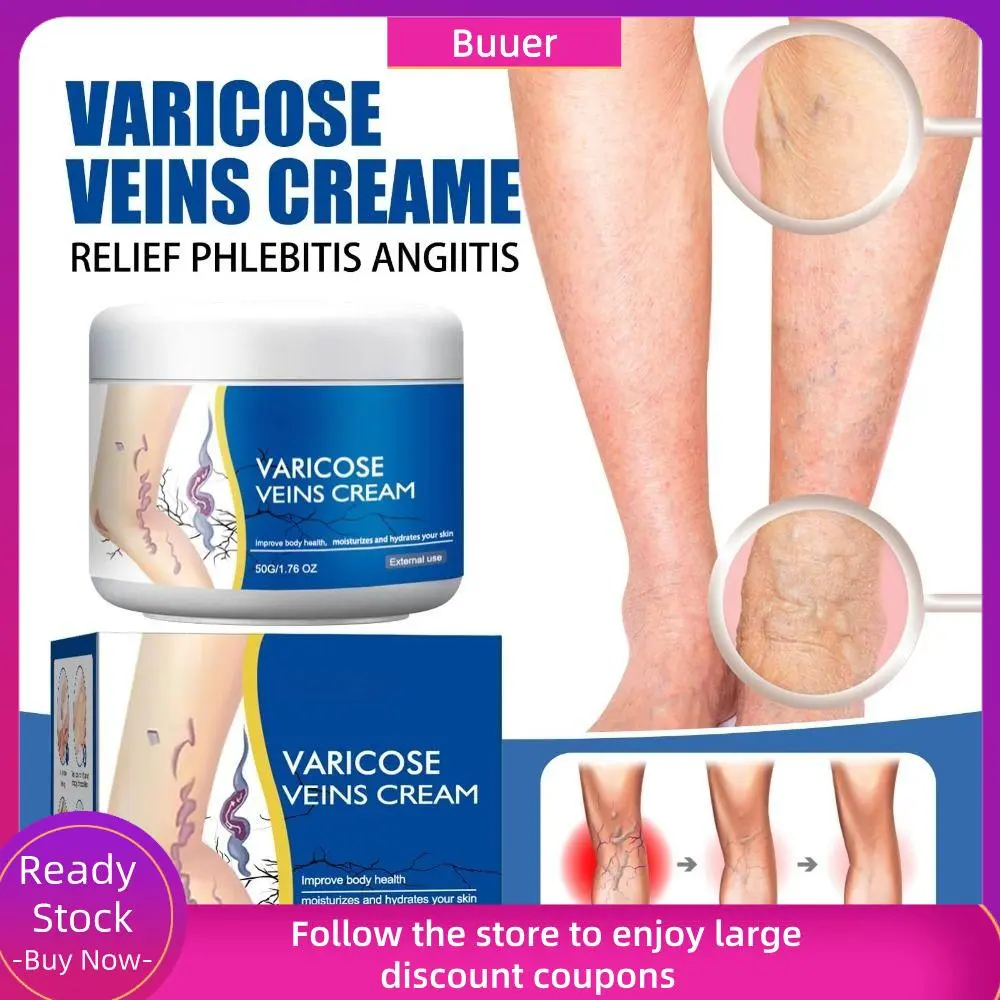 Hot 50g/1.76fl.oz Legs Varicose Veins Treatment Pain Relief Moisturizes The Skin Legs Skin Cream Mild & Safe Leg Phlebitis Cream Improve Leg Appearance
