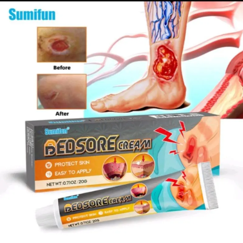 SUMIFUN BEDSORE CREAM / Krim Luka Baring / Penyembuh Luka Diabetes / Mengobati Luka Dekubitus