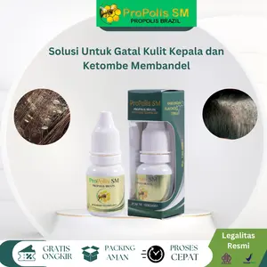 ProPolis SM Untuk Penghilang Ketombe Parah, Psioriasis Infeksi Jamur Di Kulit Kepala, kuliit kepaala berkerak, bersisik dan Gatal