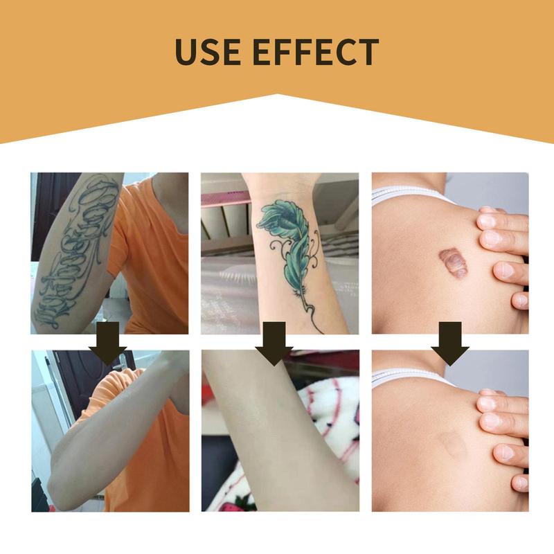 Product Introduction of Invisible Concealer Patch Skin Concealer Tattoo Scar Cover Patch Invisible Waterproof Skin Color Concealer Patch 26