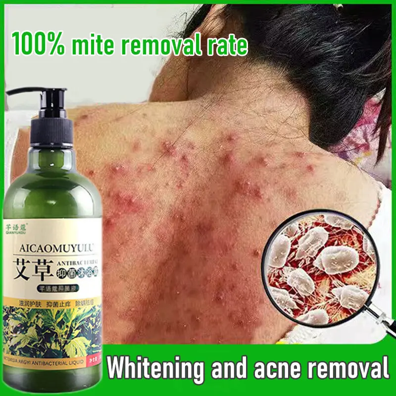 [SG SELLER]Acne Clear Body Wash 500ml Mugwort anti-mite and anti-itch shower gel Deep cleansing Antibacterial eczema
