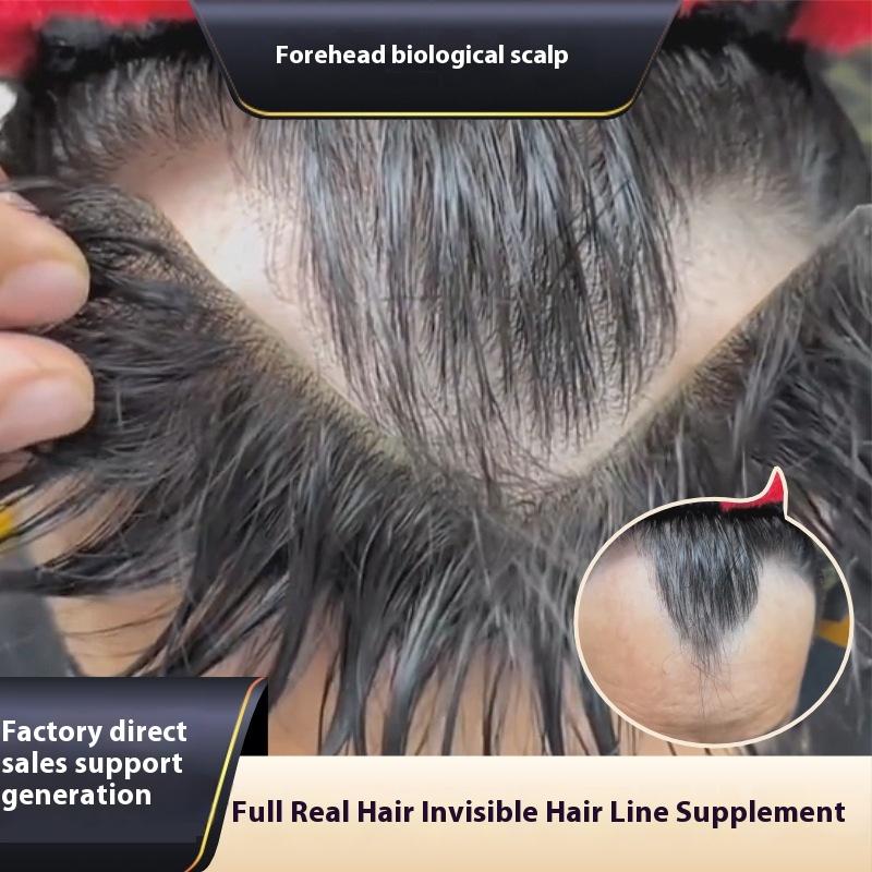 M-Style Men Toupee Forehead Hair Line Frontal Hairpiece for Men With 6 Pieces…