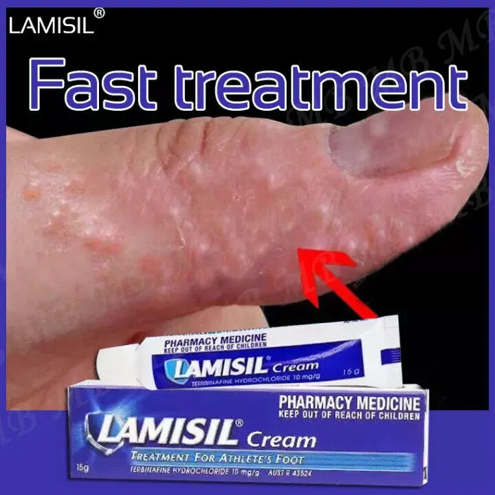 lamisil cream athletes foot cream lamisil antifungal ubat gatal kulit kaki Relieves Itching/Safe and Effective/Terbinafine Hydrocloride 15g by GoFit Phils