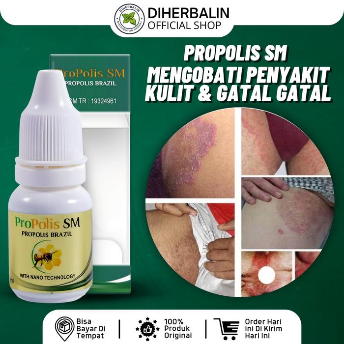 Gambar ProPolis SM Atasi Gatal Kemaluan Wanita Gatal Miss V Lecet dan Perih 6ml dari Diherbalin Shop Kota Administrasi Jakarta Barat Tokopedia