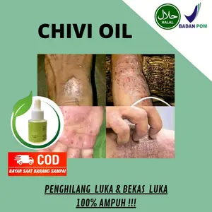 CHIVIOIL PENGHILANG LUKA EKSIM GATAL JAMUR BPOM HALAL kering panu
