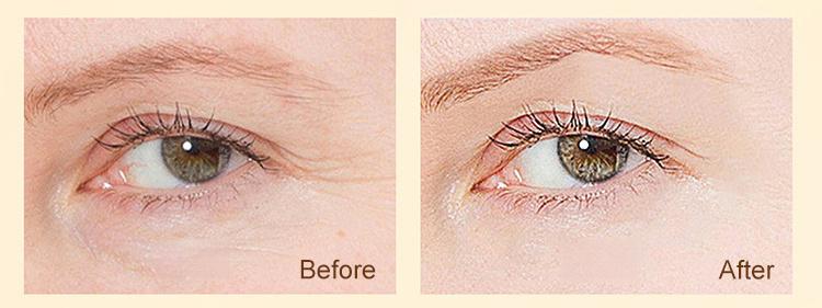 Dinkiss Eye Treatment Oil Improve Skin Radiance Reduce Wrinkles Relieve Puffiness