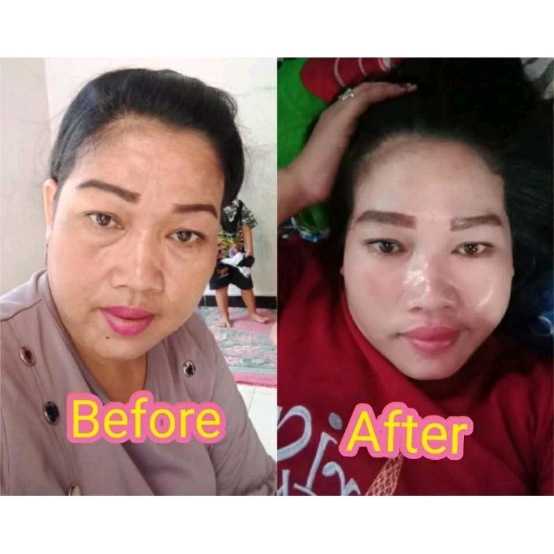 Perawatan Wajah Whitening Sunscreen Flek Mencerahkan BPOM NA18220102958 - Pencerah, Wanita 1