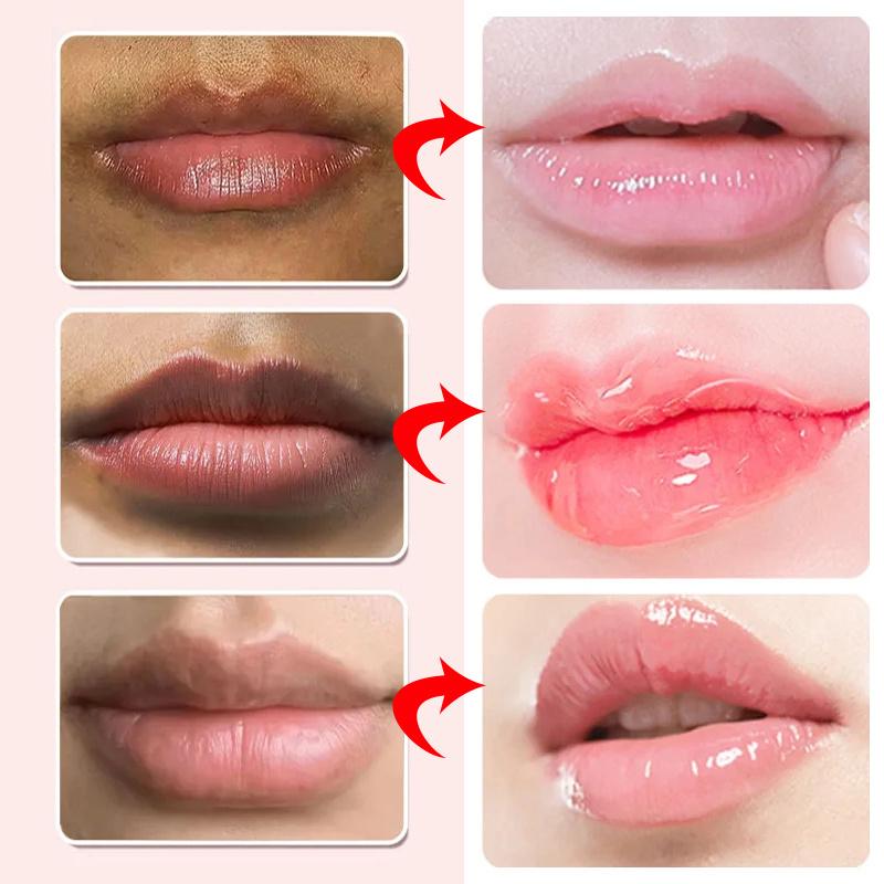 Lip Balm For Remove Dark Lip Moisturizing Lightening Melanin Whitening Plumper Extreme Gloss Pink Lips Skin Care For Men Women Comfort Moisturizer 6