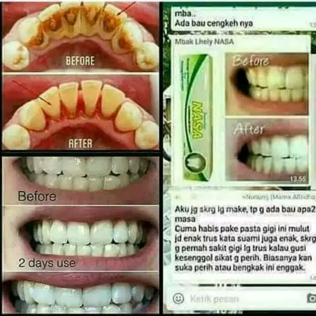 Pasta Gigi Nasa PGN Ekstrak Cengkeh Memutihkan & Merontokkan Karang Gigi - Gusi odol gigi sensitif 4