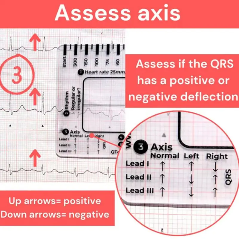 Thước 7 Bước, Cầm Tay, Hướng Dẫn Tham Khảo Bỏ Túi Giải Thích Ecg, Trong Suốt, Thiết Kế Nhỏ Gọn, Dụng Cụ Đánh Giá, Để Đo Lường 4