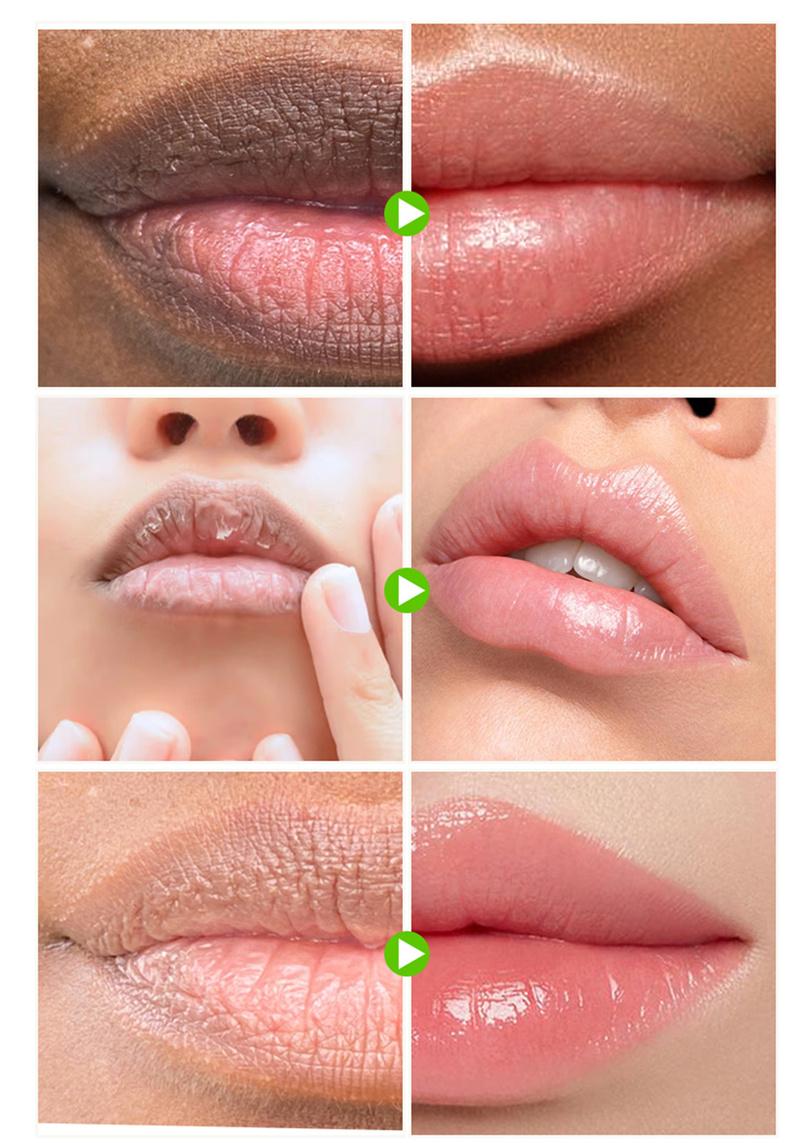 Product Introduction of Lip Balm For Remove Dark Lip Moisturizing Lightening Melanin Whitening Plumper Extreme Gloss Pink Lips Skin Care For Men Women Comfort Moisturizer 4