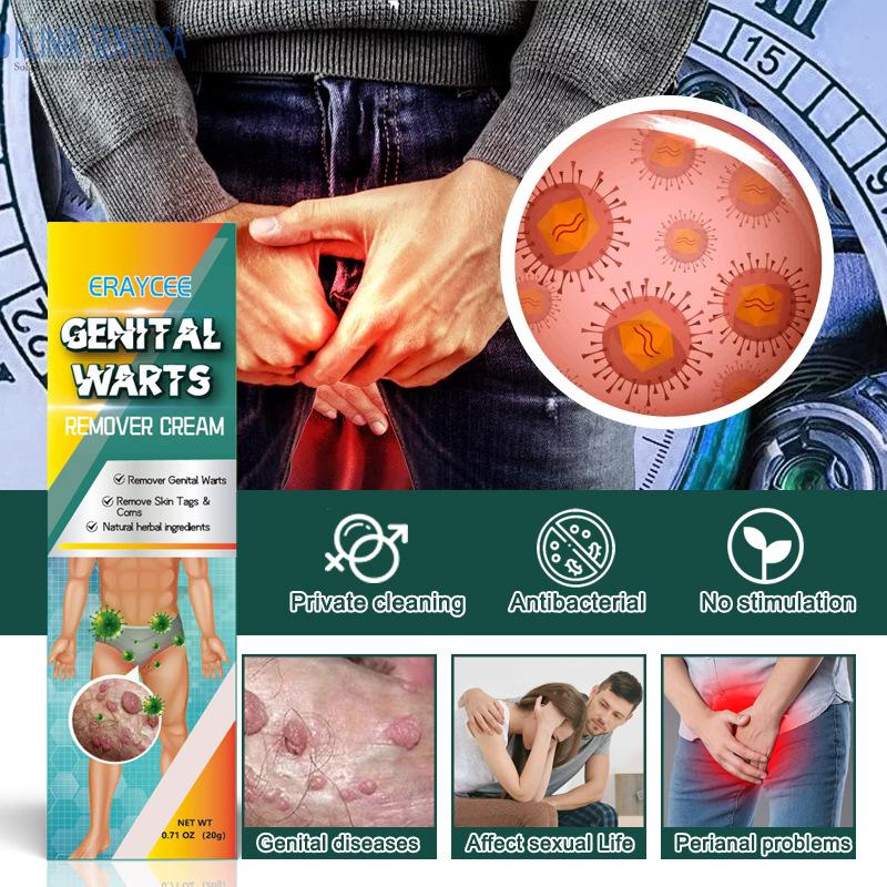 Product Introduction of Kem Loại Bỏ Mụn Cóc Thảo Dược, Dành Cho Nam Và Nữ, Sử Dụng Trên Khu Vực Riêng Tư, Pinghou You, Hiệu Quả 10
