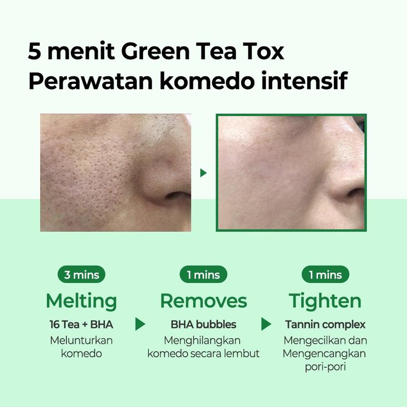 SOME BY MI Bye Bye Blackhead Green Tea Tox Bubble Mask Facial Cleanser 120g 6