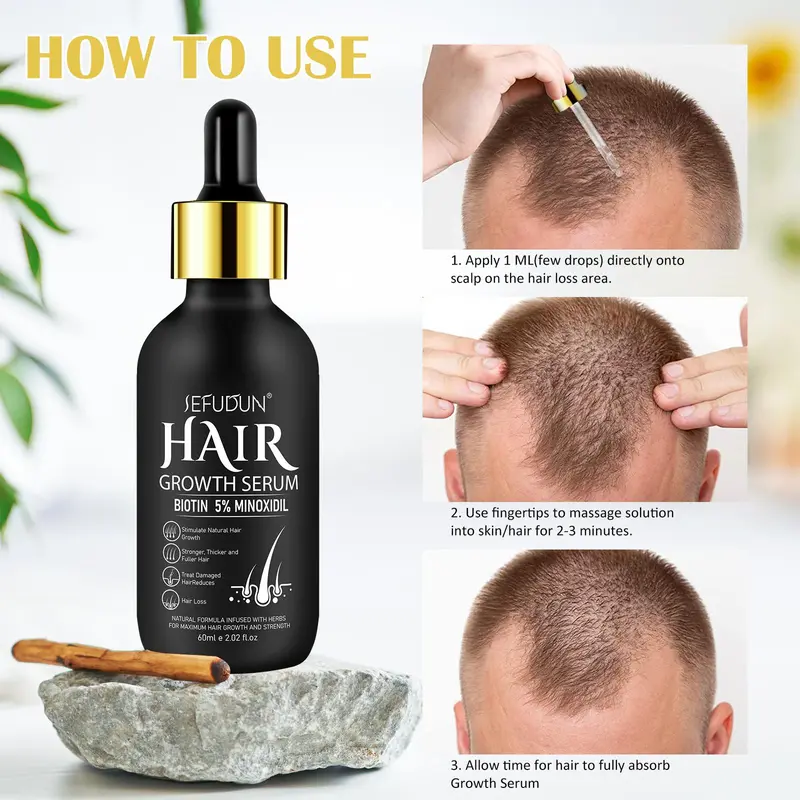 5% Minoxidil Hair Serum, Safe and Effective Hair Strengthening Serum with Biotin for Thinning Hair, Creat Fuller, Thicker Hair, Hair Care Product for Men & Women, Christmas Gift, Suitable for All Hair Types 6