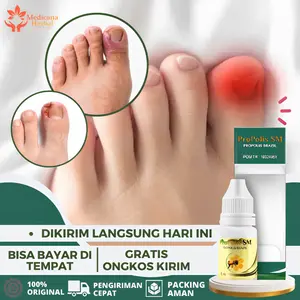 Solusi Kuku Cantengan, Cantengan Jempol Kaki, Cantengan Menahun, Cantengan Kuku Bengkak