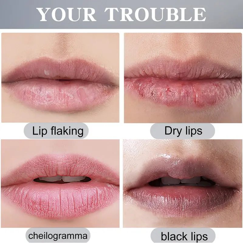 Moisturizing Lip Balm, Natural Turmeric Lip Balm, Hydrating Lip Treatment For Women & Girls 3