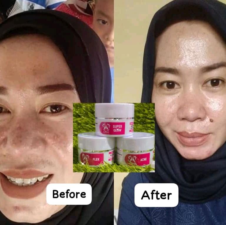 crem flek,glow,acne SPF 30 Semua Jenis Kulit 4
