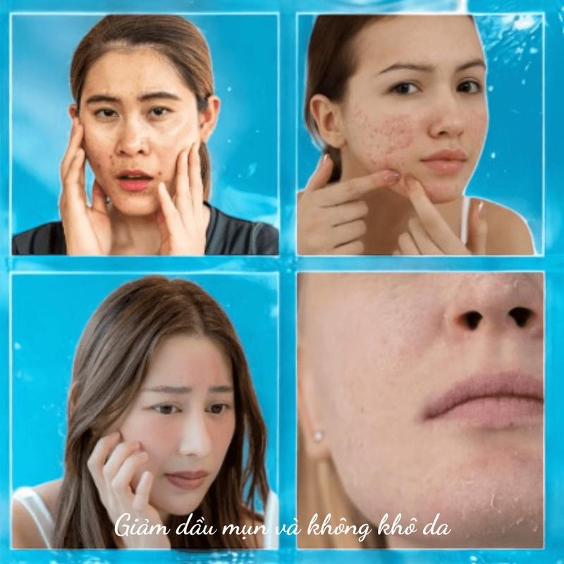 Sữa Rửa Mặt CANOVA Kiểm Soát Dầu Sạch Sâu Từ Châu Âu Canova Salipil Detergente 150ml - KIKIDA da khỏe đẹp Nữ Skincare Women Cho Bé 8
