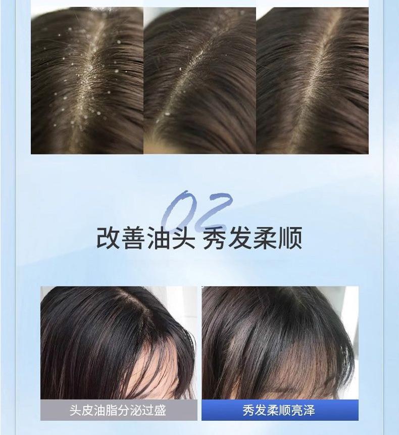 Product Introduction of Xikangwang Anti-Dandruf and Relieve Itching Washing Water Oil Removing Refreshing Skin Washing Cream Anti-Mite Grease-Overflow Moss Lotion 19