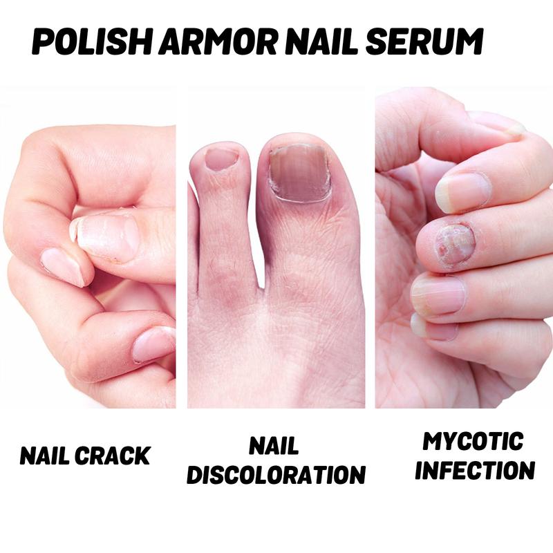 Product Introduction of Nail Treatments Epairing Hand and Foot Nails Decay, Soft Nail Care, Bright Nails Care, Nourishing Nail Fluid 10