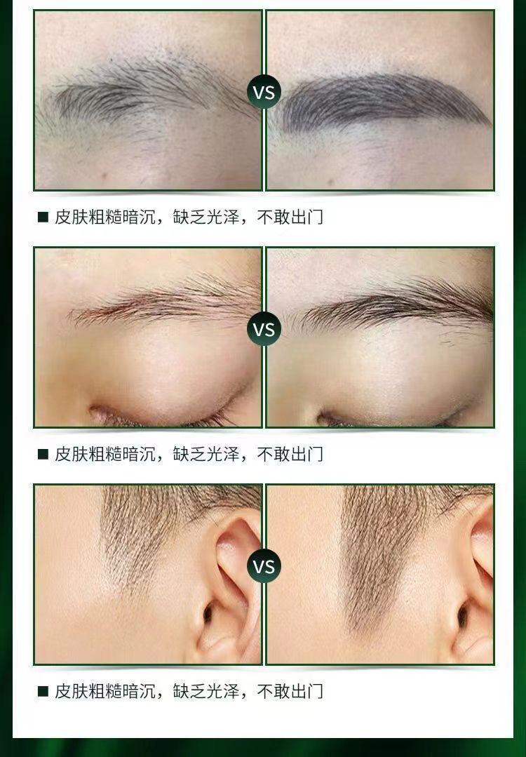 Product Introduction of Dung Dịch Mọc Lông Mi, Dưỡng Chất Cho Lông Mi, Kiểu Xoăn Và Dài, Thích Hợp Cho Nam Và Nữ, Tinh Chất Cho Lông Mày, Dày Và Dày, Có Sẵn Kiểu Lông Mi Ngắn Và Lông Mày 5