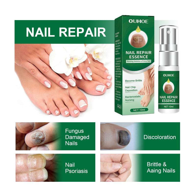 Product Introduction of 100% Original Brand Ouhoe Toenail Repair Essence Gray Nail Soft Yellow Thickening Inlay Bright Manicure Comfort 6