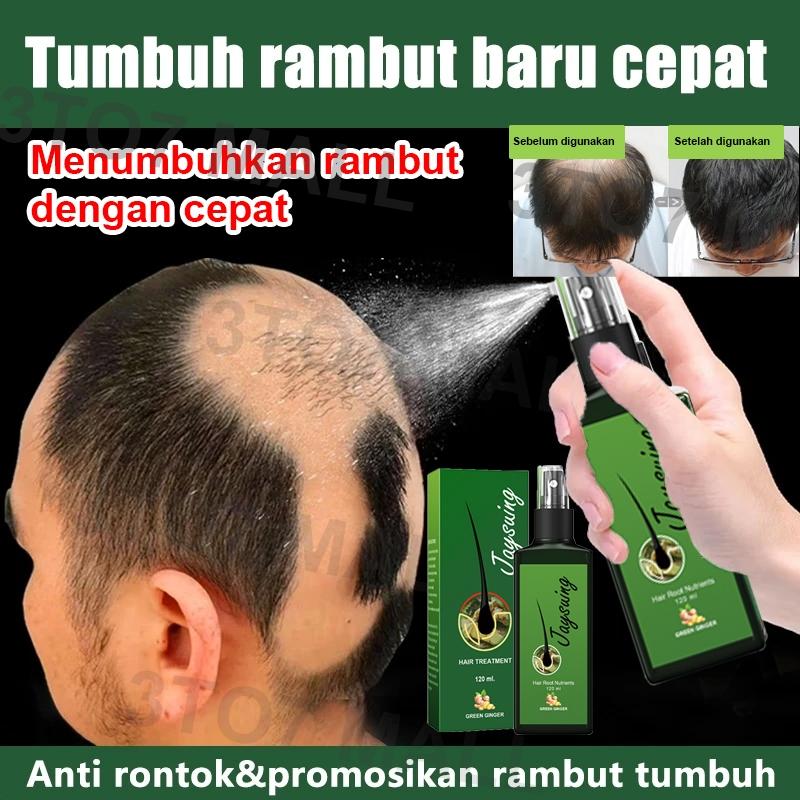 serum penumbuh rambut hair growth spray Obat penumbuh rambut penumbuh ...