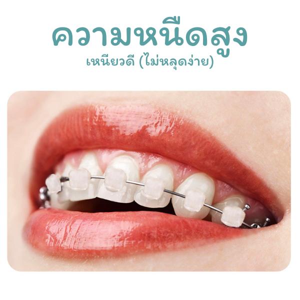 Product Introduction of ขี้ผึ้งสำหรับคนจัดฟัน ช่วยบรรเทาการบาดหรือขูดของลวดดัดฟัน พร้อมส่ง 5