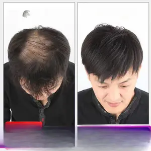 Parik kepala laki-laki, rambut nyata, parik rambut manusia penuh, rambut pendek laki-laki, dahi Mediterranean botak, rambut laki-laki patch