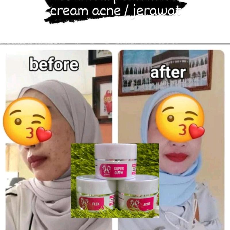 crem flek,glow,acne SPF 30 Semua Jenis Kulit 3