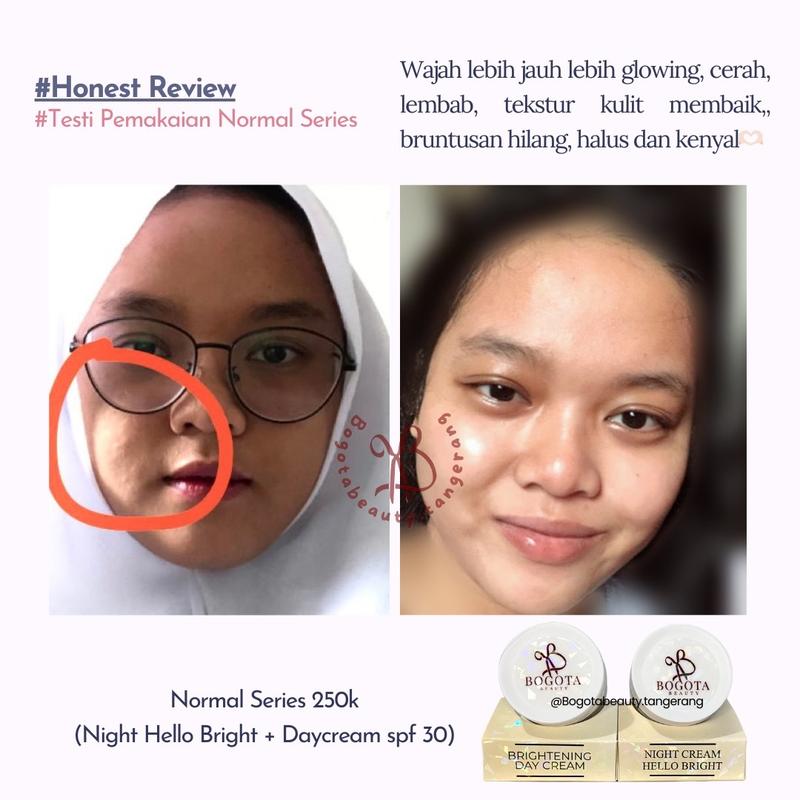 Bogota Beauty Skincare Bogota Normal Series Bogota Acne Series by Bogota Beauty Semua Jenis Kulit 5