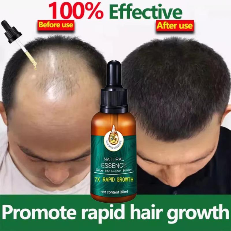 Tinh dầu kích mọc tóc nhanh ngăn ngừa rụng tóc chai tinh dầutinh chất giúp tóc mọc nhanh chống rụng tóc Tinh chất tăng trưởng tóc nhanh Hair Grower Dầu xả tóc Tinh chất ngăn ngừa rụng tóc cho nam và nữ 30ML