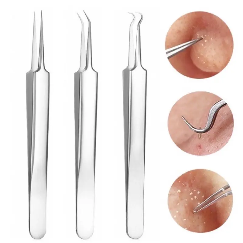 Bộ 3 Cây gắp nặn mụn đầu đen, mụn trứng cá thép không gỉ dài 8cm 4