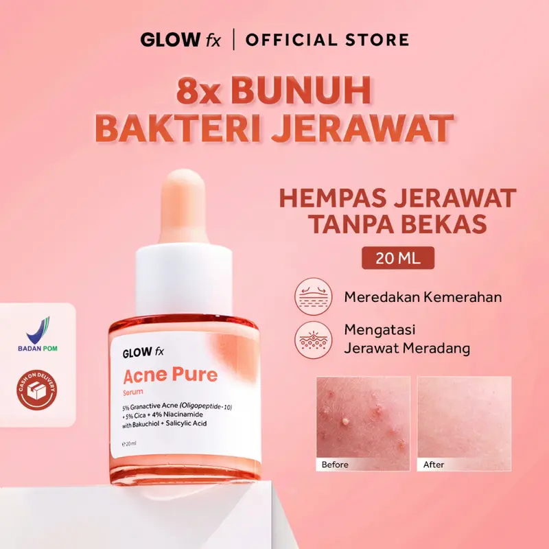 GLOW FX Glow Bomb Serum | Acne Pure Serum - Serum Glowing & Bekas Jerawat 19% Brightening Power ACNE SERUM GLOWFX GLOW FX Acne Pure Serum - Serum Untuk Jerawat GLOWFX ACNE BOMB SERUM 5