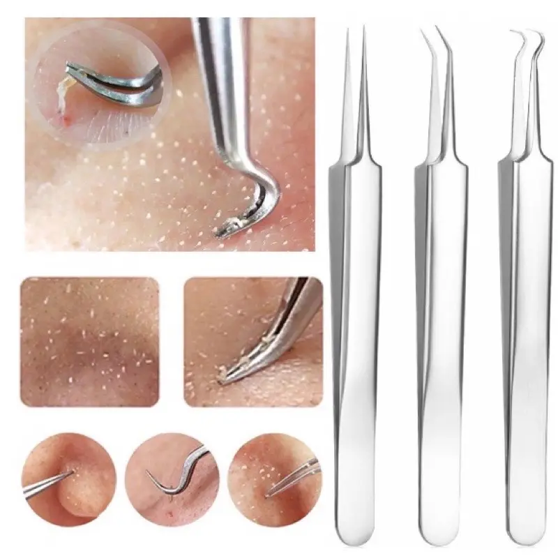 Bộ 3 Cây gắp nặn mụn đầu đen, mụn trứng cá thép không gỉ dài 8cm 0