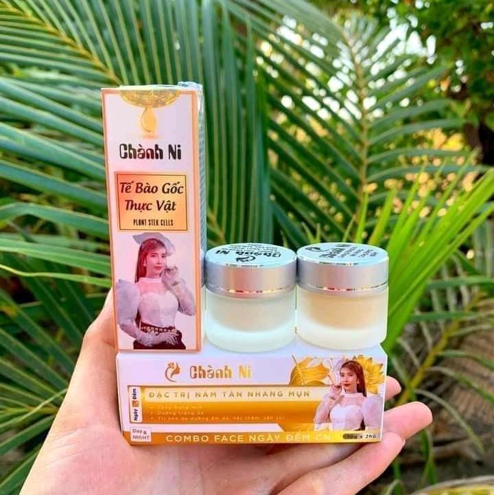Kem face ngày đêm chành ni trị mụn thâm nám tàn nhang
