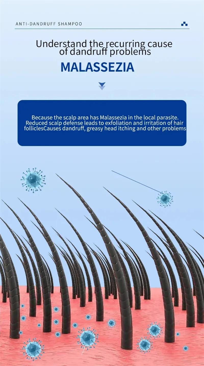 Sampo Ketombe 300ml untuk psoriasis, pereda gatal akibat selenium disulfida, sampo anti ketombe, pengontrol minyak