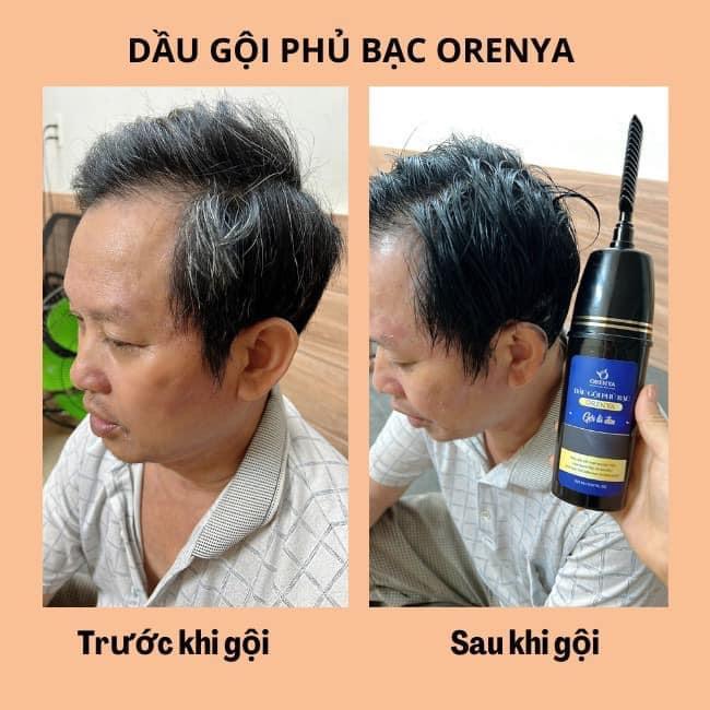 Gôi phủ bạc 2