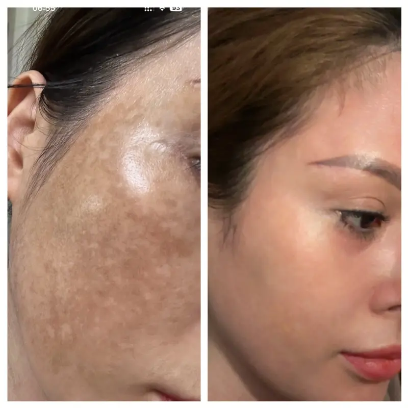 Kem Dưỡng Trắng Siêu Khử Nám - Dưỡng Da Trắng Mặt . Mùi Hương Dịu Nhẹ . face mặt nám mix 15g