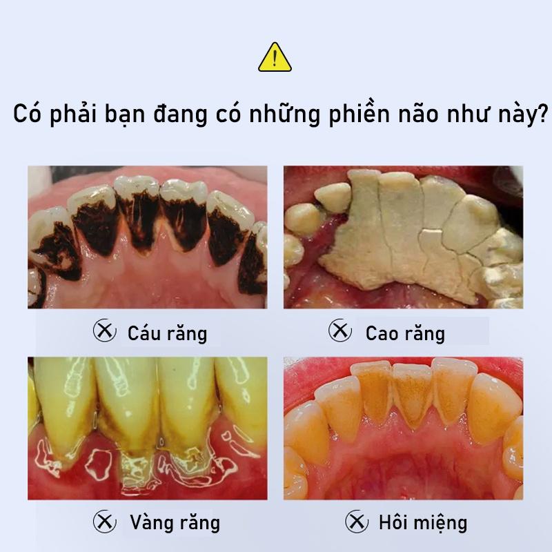 Kem Đánh Răng Làm Trắng Răng loại bỏ cao răng hôi miệng tẩy ố vàng Không Chứa Florua Kem đánh răng bạc hà 100g 2