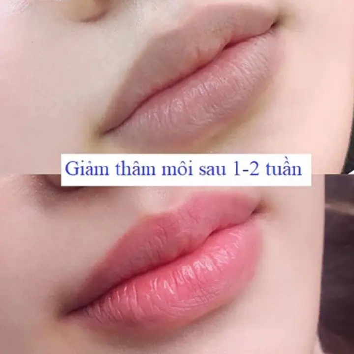 Dưỡng môi Collagen giảm thâm, kích màu môi sau phun xăm, dưỡng môi căng bóng, mềm mượt hũ 5g 2