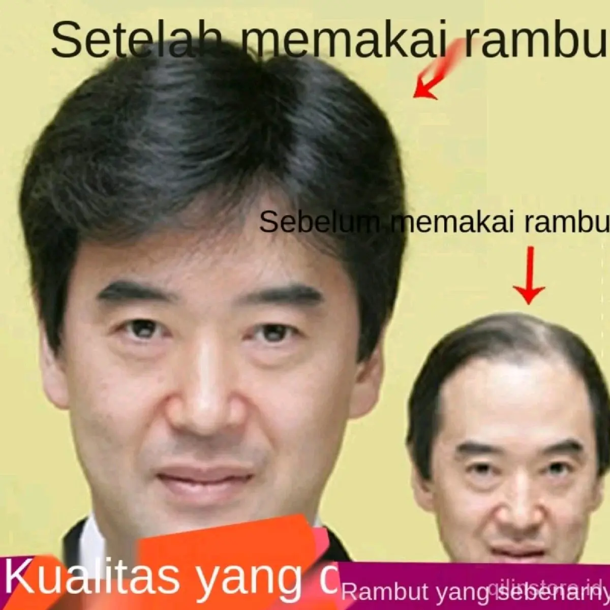 Penutup Botak Rambut Pendek Hitam Model Opa Korea