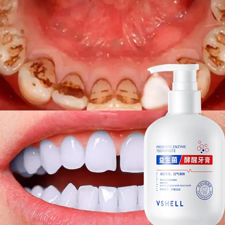 Kem Đánh Răng Làm Trắng Răng Giảm Vết Ố Vàng Trên Răng giảm sâu răng Giữ Hơi Thở Thơm Mát 250g Women Nữ