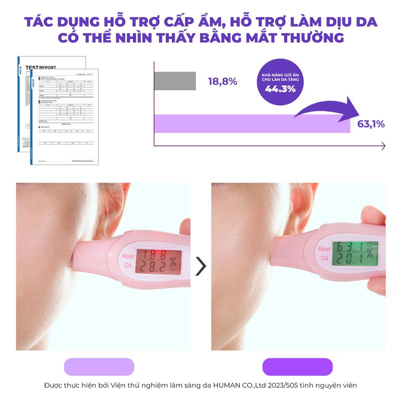 [KOL] - Tinh Chất Dịch Lọc Ốc Sên Hỗ Trợ Làm Dịu Và Hỗ Trợ Phục Hồi Dành Cho Da Dầu Mụn, Nhạy CảmTIA'M Snail & Azulene Water Essence 180ML Nữ 3