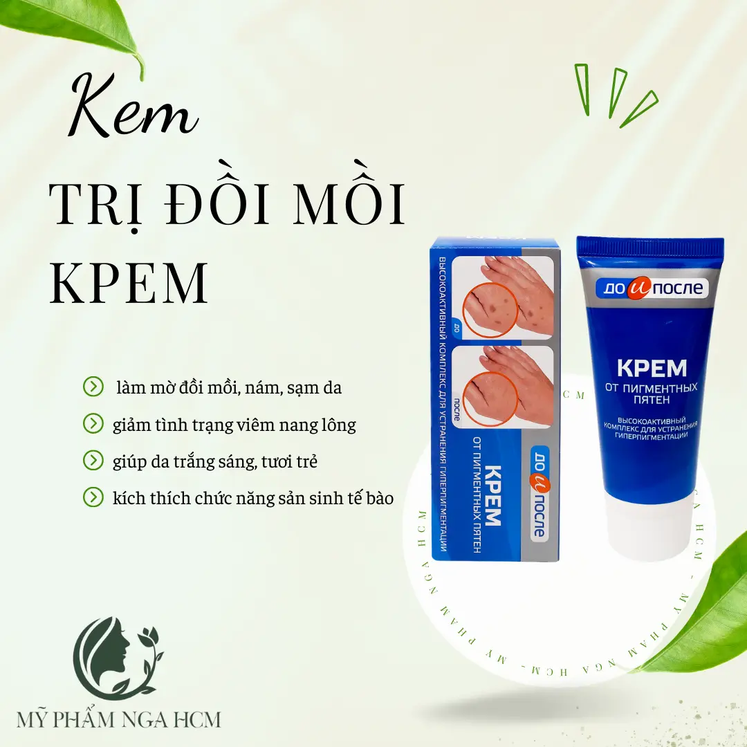 Kem chống đồi mồi Nga - Kem xóa đồi mồi Kpem
