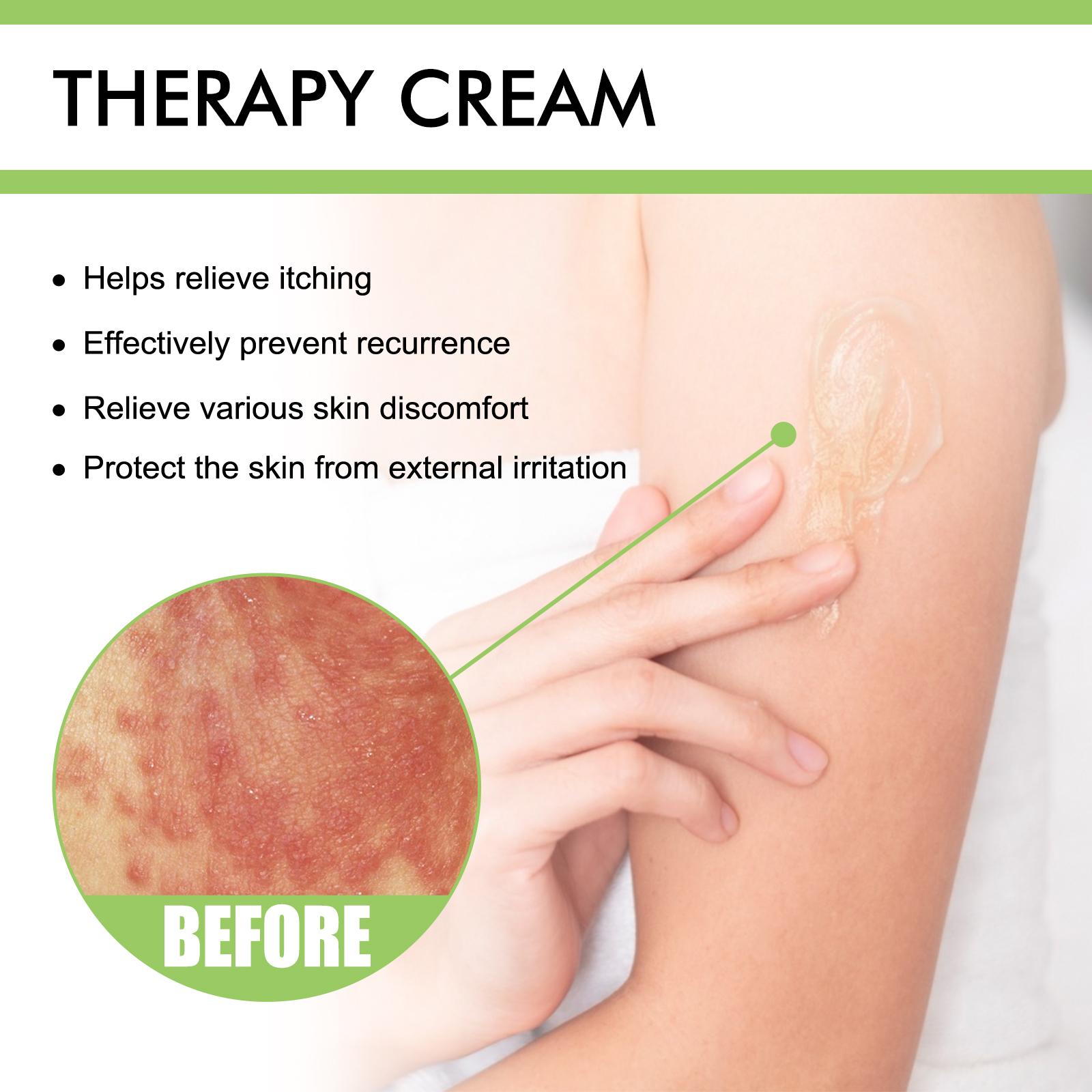 GATAL & KURAP LENYAP! South Moon Salep Rp69rb